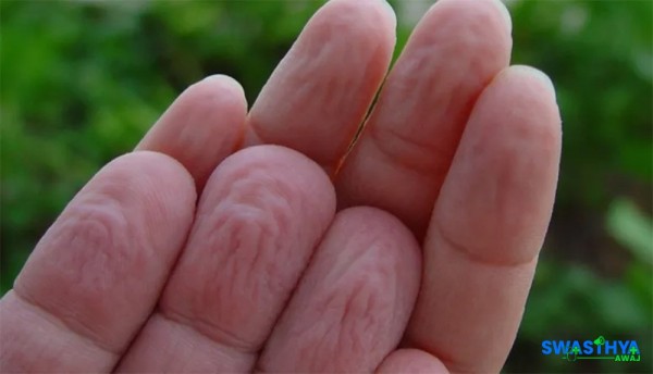 पानीमा लामो समय राख्दा औंलाहरू चाउरी हुने प्रक्रिया र स्वास्थ्य संकेत